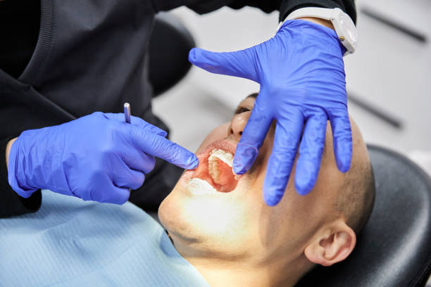 Best Emergency Broken Tooth Repair in Indian Hills, TX